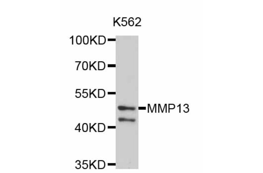Western Blot - Anti-MMP13 Antibody (A2427) - Antibodies.com