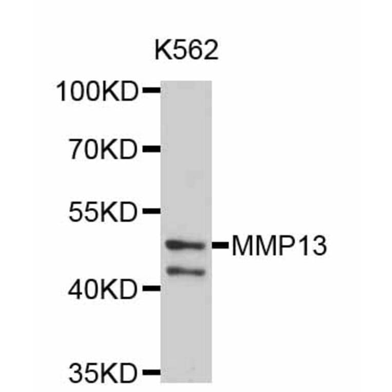 Western Blot - Anti-MMP13 Antibody (A2427) - Antibodies.com