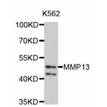 Western Blot - Anti-MMP13 Antibody (A2427) - Antibodies.com