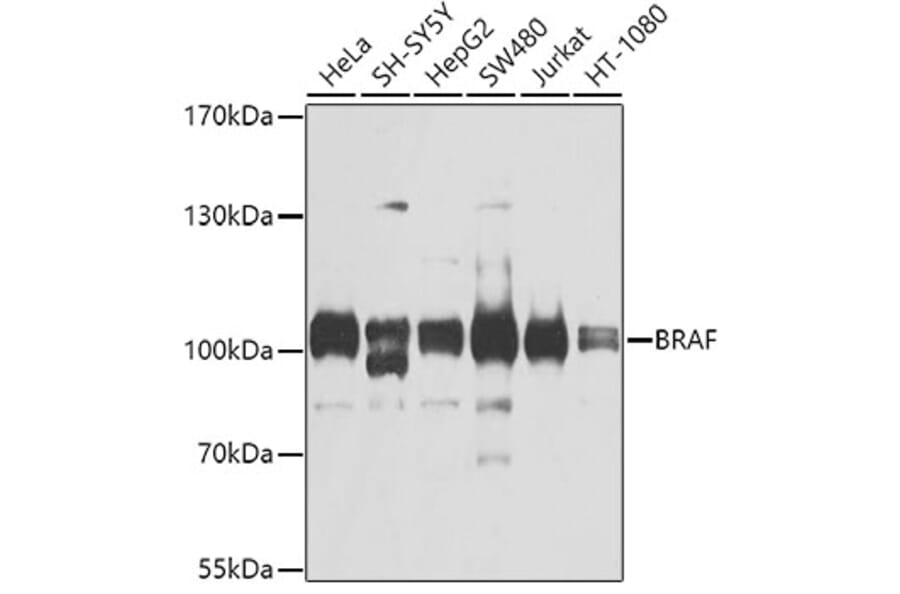 Western Blot - Anti-BRAF Antibody (A2434) - Antibodies.com