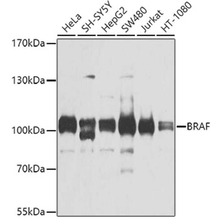 Western Blot - Anti-BRAF Antibody (A2434) - Antibodies.com
