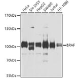 Western Blot - Anti-BRAF Antibody (A2434) - Antibodies.com