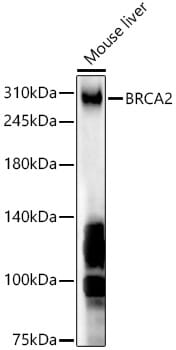 Western blot analysis of extracts of 293T cells, using Anti-BRCA2 Antibody (A2435) at 1:1,000 dilution.
Secondary antibody: Goat Anti-Rabbit IgG (H+L) (HRP) (AS014) at 1:10,000 dilution.
Lysates / proteins: 25µg per lane.
Blocking buffer: 3% non-fat dry milk in TBST.
Detection: ECL Basic Kit (RM00020).
Exposure time: 90s.