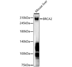 Western Blot - Anti-BRCA2 Antibody (A9045) - Antibodies.com