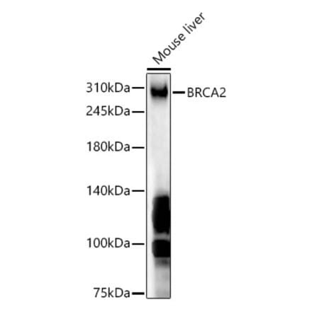 Western Blot - Anti-BRCA2 Antibody (A9045) - Antibodies.com