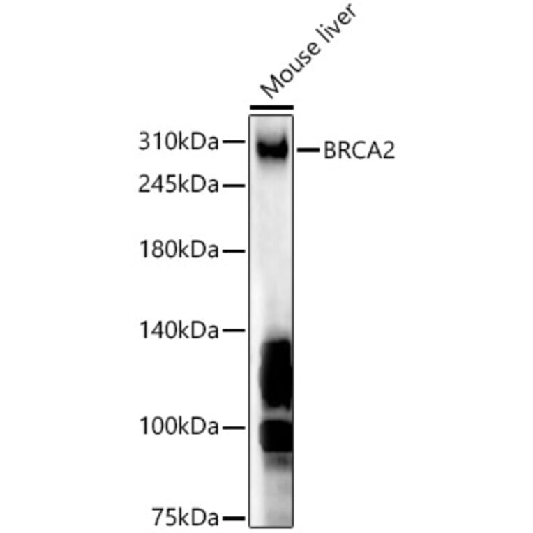 Western Blot - Anti-BRCA2 Antibody (A9045) - Antibodies.com