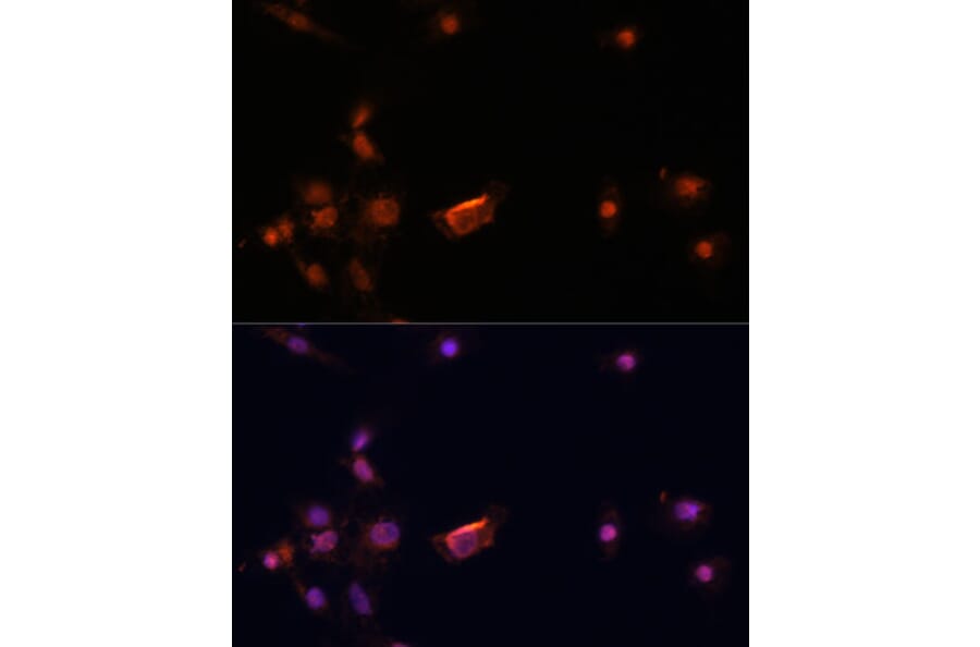 Immunofluorescence - Anti-BRCA2 Antibody (A9045) - Antibodies.com