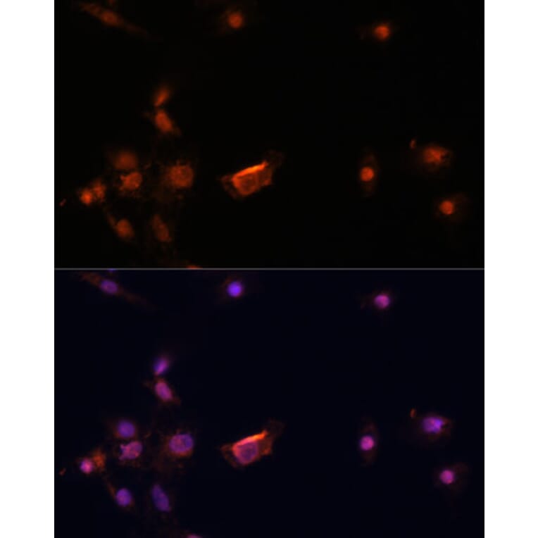 Immunofluorescence - Anti-BRCA2 Antibody (A9045) - Antibodies.com