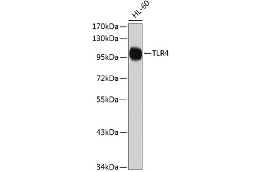 Western Blot - Anti-TLR4 Antibody (A2464) - Antibodies.com