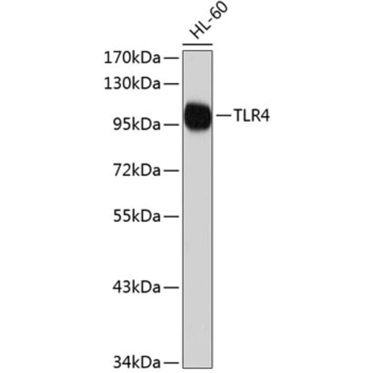 Western Blot - Anti-TLR4 Antibody (A2464) - Antibodies.com