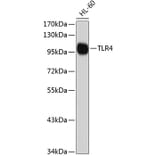 Western Blot - Anti-TLR4 Antibody (A2464) - Antibodies.com