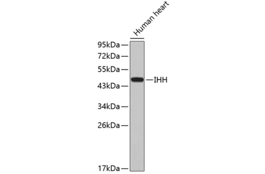 Western Blot - Anti-IHH Antibody (A2474) - Antibodies.com