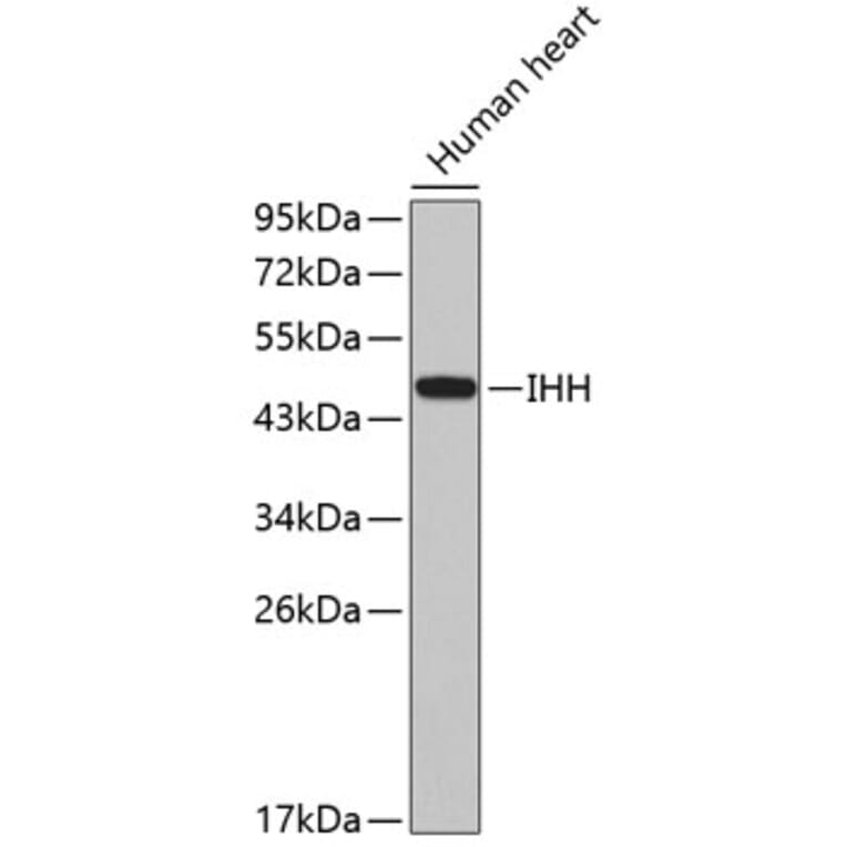Western Blot - Anti-IHH Antibody (A2474) - Antibodies.com