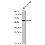 Western Blot - Anti-IHH Antibody (A2474) - Antibodies.com