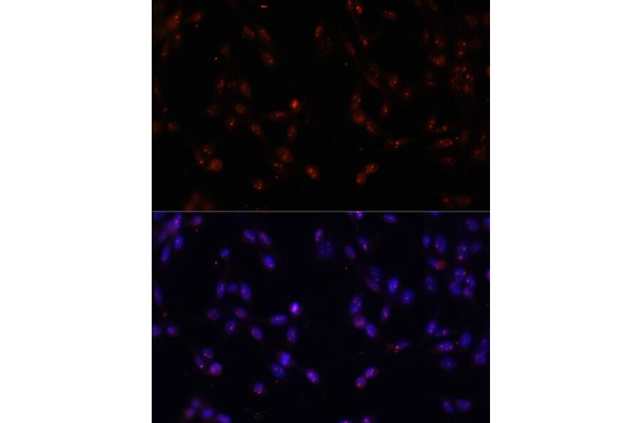 Immunofluorescence - Anti-ILF3 Antibody (A9053) - Antibodies.com