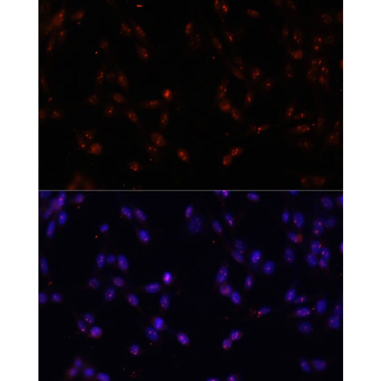 Immunofluorescence - Anti-ILF3 Antibody (A9053) - Antibodies.com