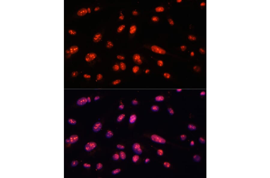 Immunofluorescence - Anti-ILF3 Antibody (A9053) - Antibodies.com