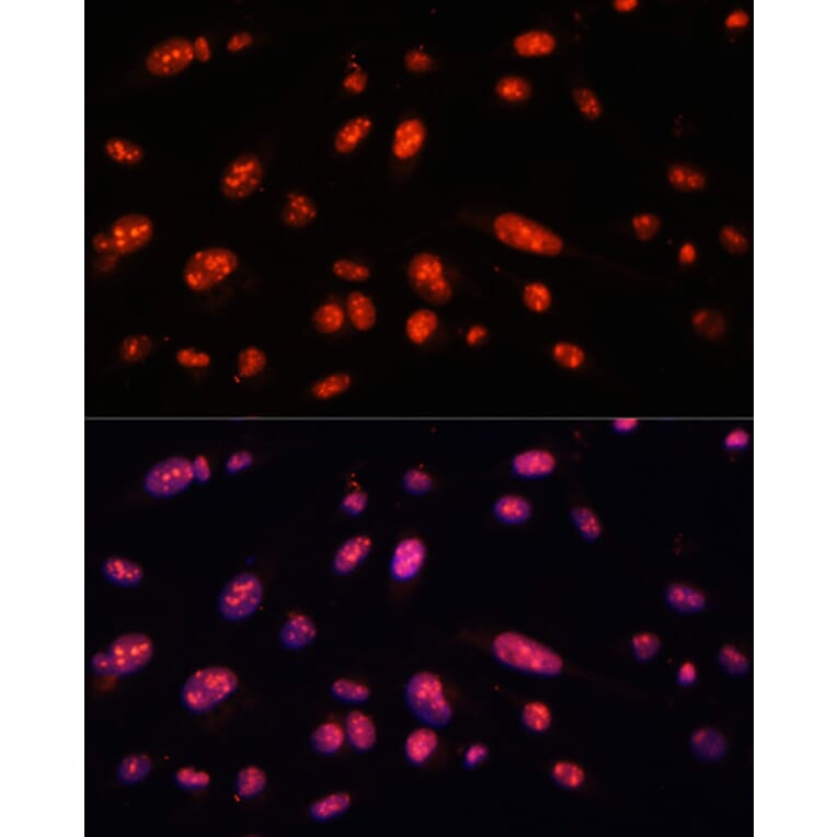 Immunofluorescence - Anti-ILF3 Antibody (A9053) - Antibodies.com