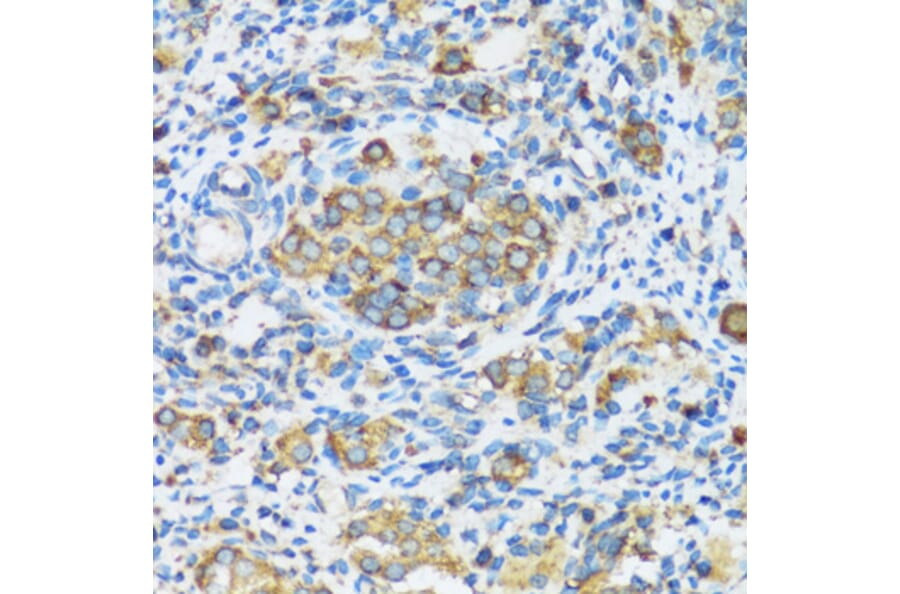 Immunohistochemistry - Anti-APOBEC3F Antibody (A9054) - Antibodies.com