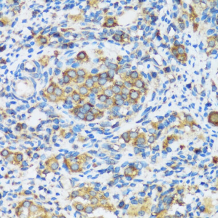 Immunohistochemistry - Anti-APOBEC3F Antibody (A9054) - Antibodies.com