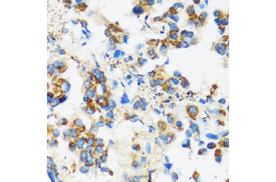 Immunohistochemistry - Anti-APOBEC3F Antibody (A9054) - Antibodies.com