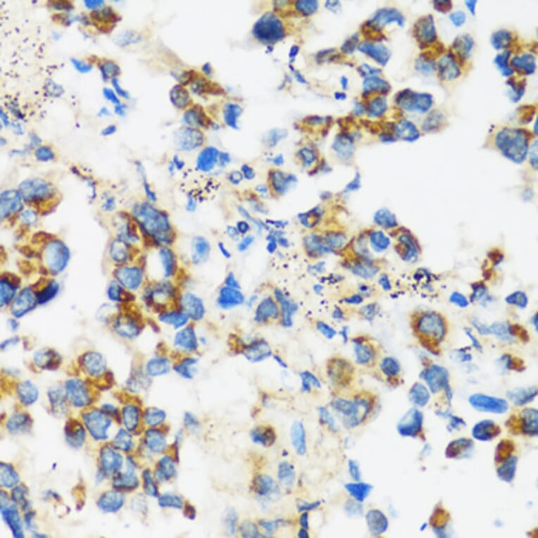 Immunohistochemistry - Anti-APOBEC3F Antibody (A9054) - Antibodies.com