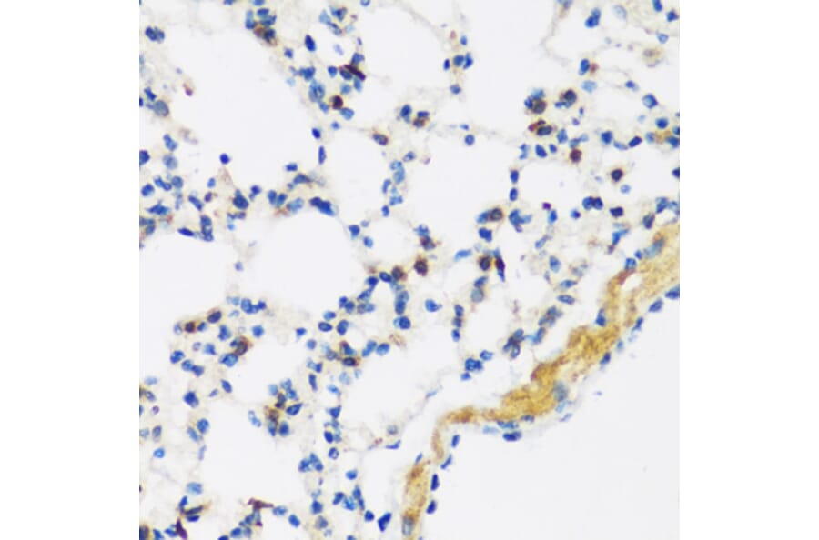 Immunohistochemistry - Anti-APOBEC3F Antibody (A9054) - Antibodies.com