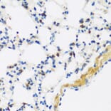 Immunohistochemistry - Anti-APOBEC3F Antibody (A9054) - Antibodies.com