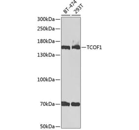 Western Blot - Anti-TCOF1 Antibody (A9055) - Antibodies.com