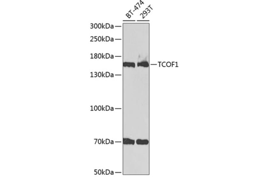 Western Blot - Anti-TCOF1 Antibody (A9055) - Antibodies.com