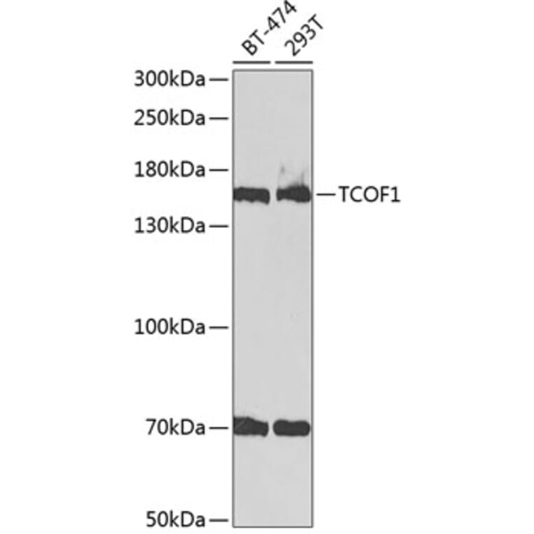 Western Blot - Anti-TCOF1 Antibody (A9055) - Antibodies.com