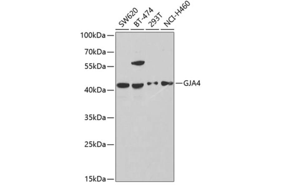 Western Blot - Anti-Cx37/GJA4 Antibody (A9056) - Antibodies.com