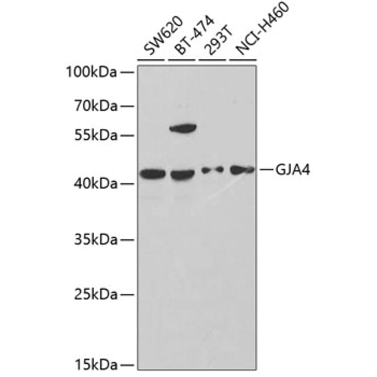Western Blot - Anti-Cx37/GJA4 Antibody (A9056) - Antibodies.com