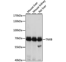 Western Blot - Anti-TN-X Antibody (A9057) - Antibodies.com