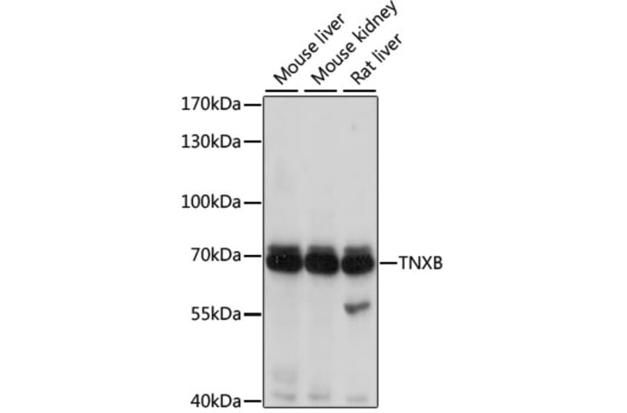 Western Blot - Anti-TN-X Antibody (A9057) - Antibodies.com