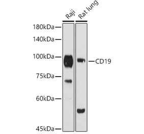 Western Blot - Anti-CD19 Antibody (A9058) - Antibodies.com