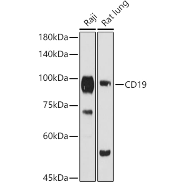 Western Blot - Anti-CD19 Antibody (A9058) - Antibodies.com