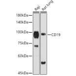 Western Blot - Anti-CD19 Antibody (A9058) - Antibodies.com