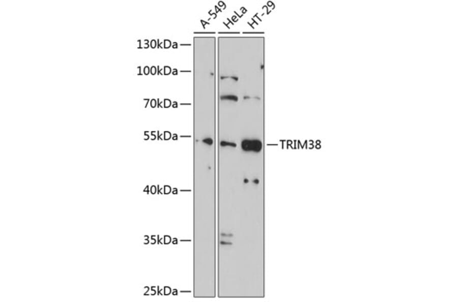 Western Blot - Anti-TRIM38 Antibody (A9059) - Antibodies.com