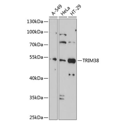 Western Blot - Anti-TRIM38 Antibody (A9059) - Antibodies.com