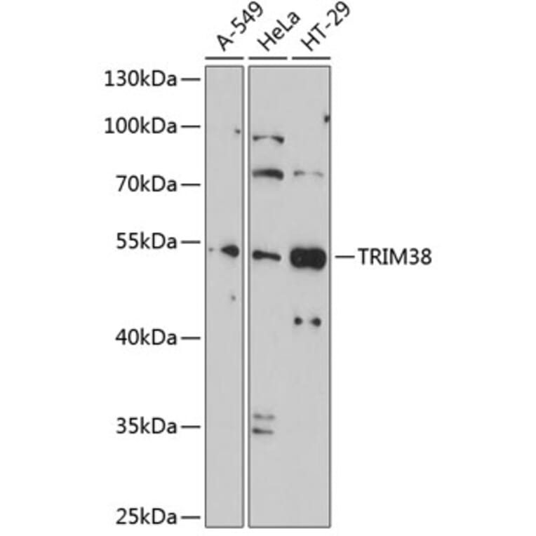 Western Blot - Anti-TRIM38 Antibody (A9059) - Antibodies.com