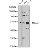 Western Blot - Anti-TRIM38 Antibody (A9059) - Antibodies.com