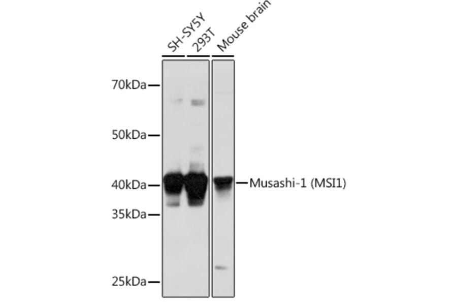Western Blot - Anti-Musashi 1/Msi1 Antibody (A9061) - Antibodies.com
