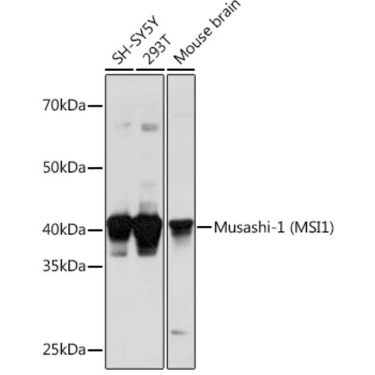 Western Blot - Anti-Musashi 1/Msi1 Antibody (A9061) - Antibodies.com