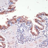 Immunohistochemistry - Anti-Musashi 1/Msi1 Antibody (A9061) - Antibodies.com