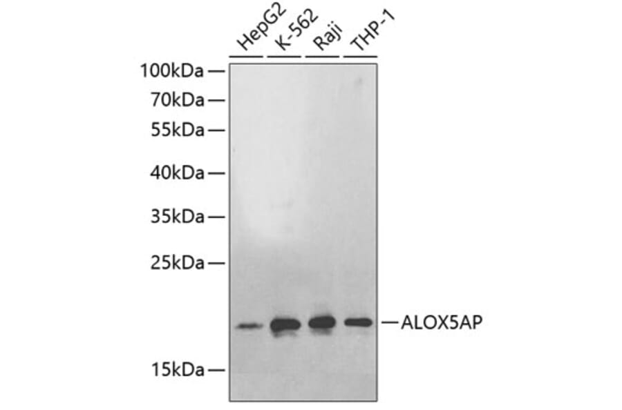 Western Blot - Anti-ALOX5AP Antibody (A2620) - Antibodies.com