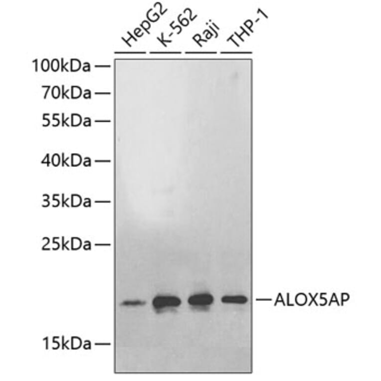 Western Blot - Anti-ALOX5AP Antibody (A2620) - Antibodies.com
