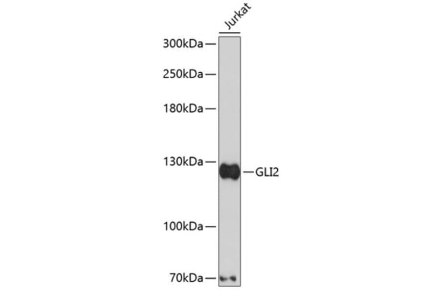Western Blot - Anti-Gli2 Antibody (A2623) - Antibodies.com
