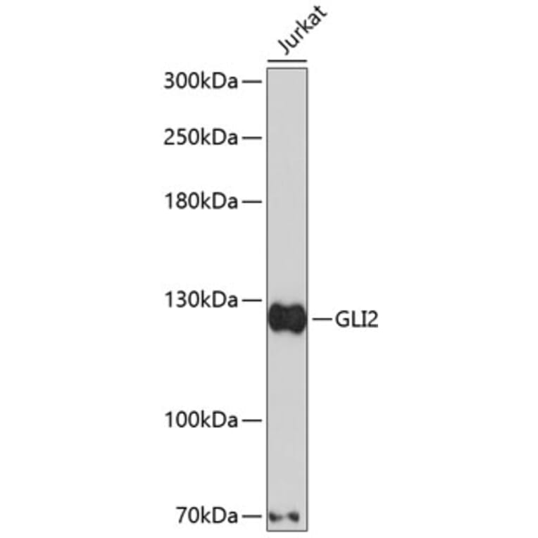 Western Blot - Anti-Gli2 Antibody (A2623) - Antibodies.com