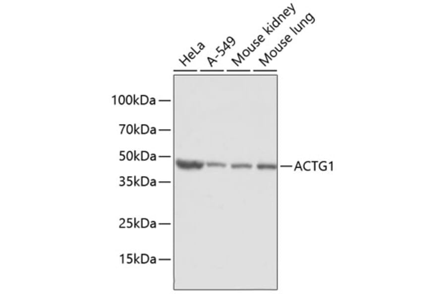 Western Blot - Anti-ACTG1 Antibody (A2631) - Antibodies.com